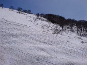 リフトの右側 リフトの右側